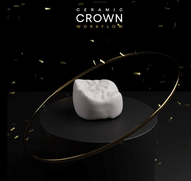Smile Design and 3D Printing of Definitive Ceramic Crowns