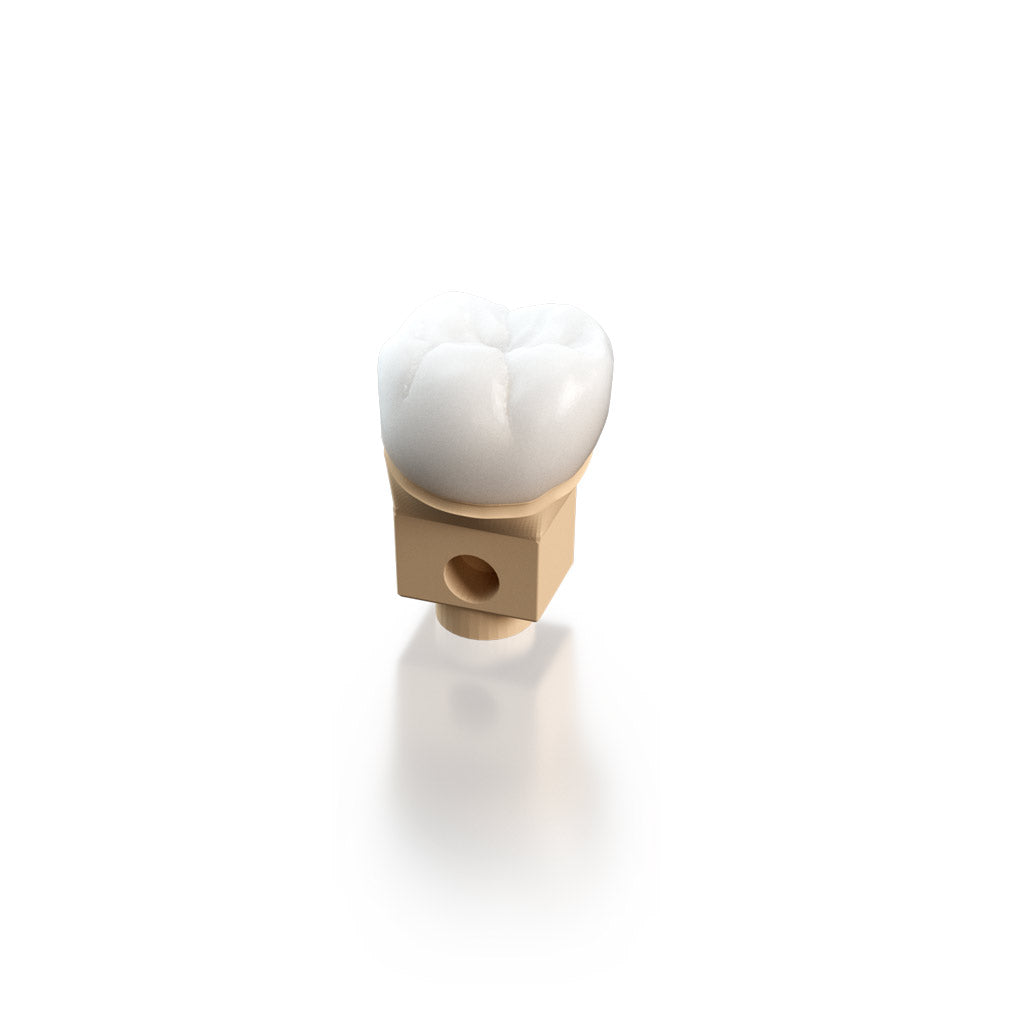 [Sample] Definitive Crown A1 + Base