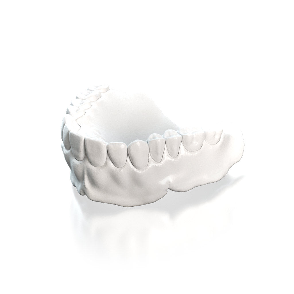 [Sample] Try In Denture