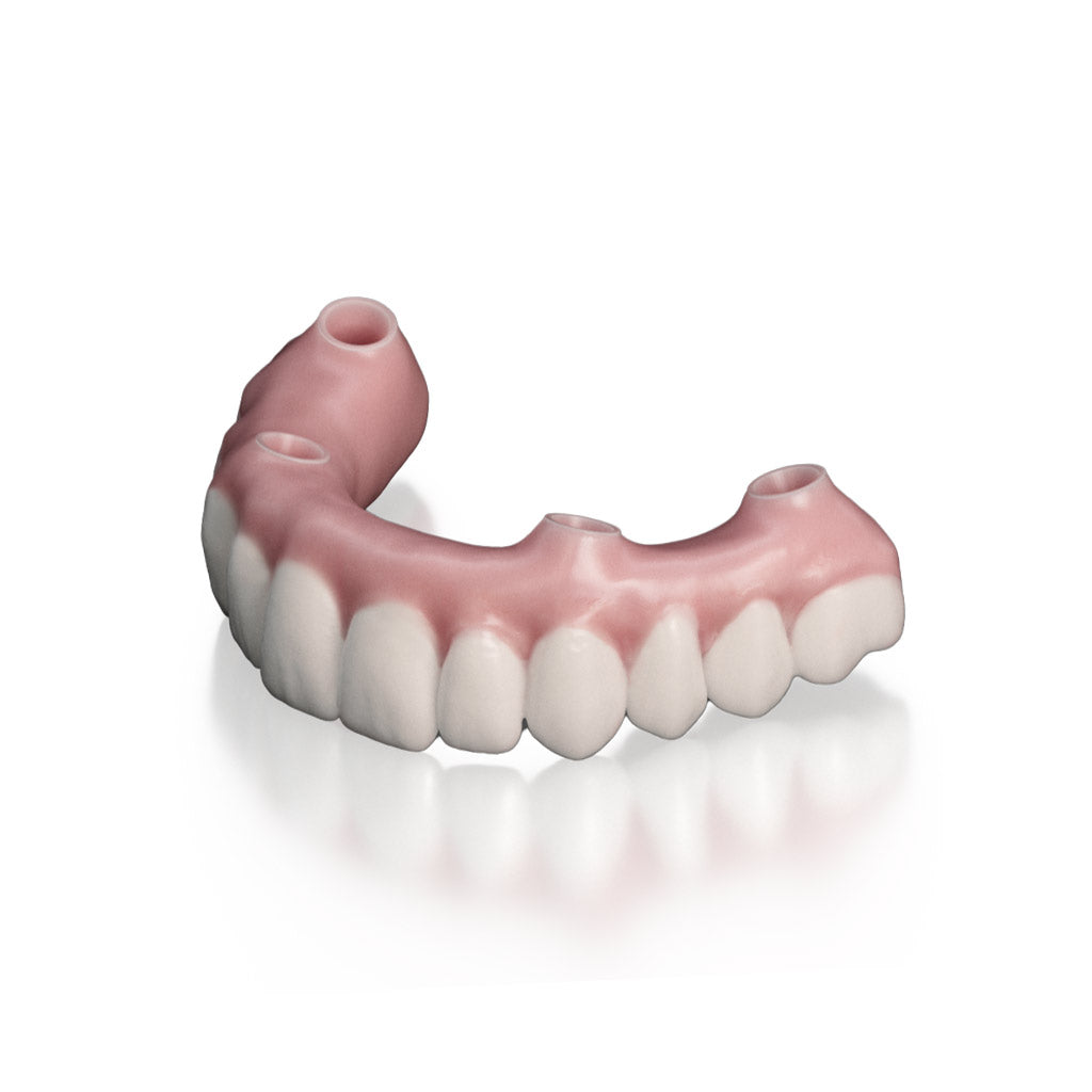 [Sample] Hybrid Denture - OnX Tough 2