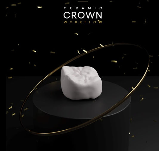 Smile Design and 3D Printing of Definitive Ceramic Crowns